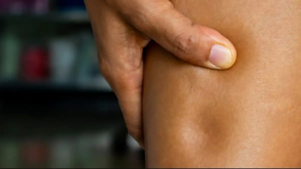 Vücuttan Ödem nasıl atılır?